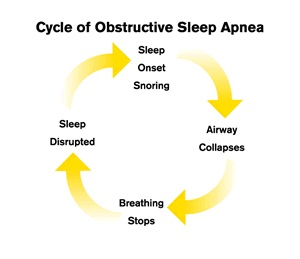 Cycle of obstructive sleep apnea